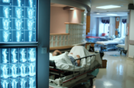 Ostéoporose : mieux dépister pour réduire le coût des fractures 